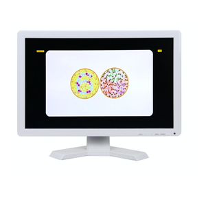Profesyonel Ray <span class=keywords><strong>Vision</strong></span> Elite Dijital Görme Cihazı (Plastik) Oftalmoloji ve Klinik Kullanımı için - Product Image 3