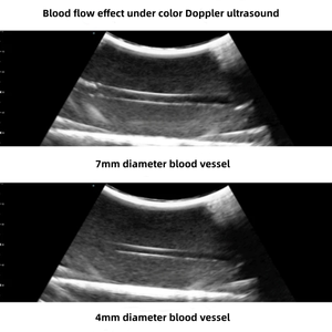Tragbares Modul für Ultraschallgesteuerte Gefäßpunktion, Artero-Venen-Punktion & PICC-Katheterisierungs-Schulung - Product Image 5