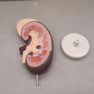 Modelo Anatómico de Riñón con Glándula Adrenal - Herramienta de Enseñanza de Nefrología Desmontable - Product Image 2