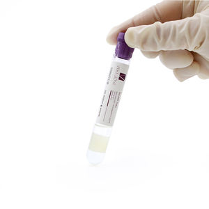 Tek Kullanımlık 8ml HA <span class=keywords><strong>PRP</strong></span> Tüpü Vakumlu Kan Alma Tüpü - Product Image 6