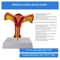 Système reproducteur féminin modèle anatomique utérus et ovaire simulateur d'enseignement gynécologique pour la science médicale