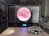 Kamera Endoskopi Laparoskopi HD untuk Perangkat Medis, Sistem Endoskopi Portabel untuk Laparoskopi