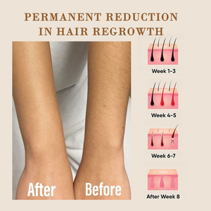 KM <span class=keywords><strong>LASER</strong></span> 2026 NUOVO MODELLO Macchina <span class=keywords><strong>Laser</strong></span> per Epilazione con Striscia Luminosa a Diodi e 6 Testine con Diverse Dimensioni di Spot - Product Image 5