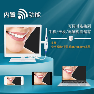 Endoscopio Dental con Wifi, Toma de Fotos, Monitor de Alta Definición de 17 Pulgadas, Escáner Intraoral Médico - Product Image 2