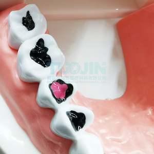 Modello Dentale Didattico per Bambini, Modello di Cura Dentale, Modello di Studio Odontoiatrico per Insegnamento e Carie, Tipodonte - Product Image 2