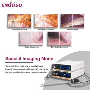 Sistema de cámara endoscópica de vídeo ENDOSO 4K Ultra HD con registro USB para artroscopia ENT laparoscopia histeroscopia toracoscopia - Product Image 4