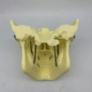 <span class=keywords><strong>Fracture</strong></span> osseuse fixe avec plaque de titane et modèle de <span class=keywords><strong>crâne</strong></span> dentaire Ortho Implant - Product Image 5