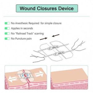 Latest Design White Color Surgical Skin Wound Fixation Care Dressing - Product Image 6