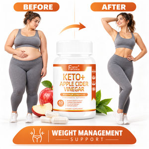 Nuevo Extracto de Vinagre de Sidra de Manzana Keto Shecome, Apoya un Estilo de Vida Saludable, Control de Peso, Cápsulas de Vinagre de Sidra de Manzana Keto - Product Image 2