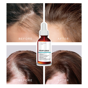 <span class=keywords><strong>Tonique</strong></span> personnalisé pour la perte de cheveux polygonum multiflorum multi-peptide densité repousse sérum de croissance des cheveux - Product Image 4