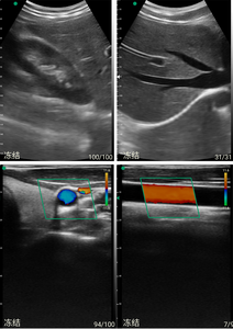 Cor animal sem fio doppler sonda linear ecocardiografia ultra-som máquina - Product Image 5