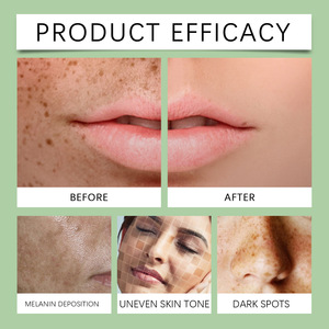 Crema OUHOE para Eliminar Manchas, Melasma, Imperfecciones, Crema Blanqueadora Fuerte para Eliminar Pecas y Corrector Facial - Product Image 6