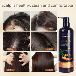 Etiqueta privada Anti pérdida de cabello Juegos de cuidado Proteína de seda Queratina Colágeno Herbal Ginseng Champú y acondicionador para el cabello - Product Image 5