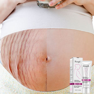 Crème à la Mangue pour Vergetures de Grossesse, Répare les Cicatrices et les Vergetures Abdominales - Product Image 3