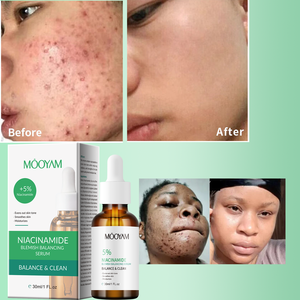 30 ml 5% Niacinamide tinh chất huyết thanh Công thức nhẹ nhàng cho làn da nhạy cảm làm giảm nhược điểm và cải thiện kết cấu da OEM - Product Image 1
