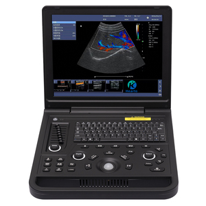 Escáner de Ultrasonido Doppler a Color para Detección del Latido Fetal en Clínicas, Económico y de Bajo Costo - Product Image 2