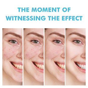 Gel Anti-Imperfections Éliminant l'Acide Salicylique, Réparateur de Cicatrices d'Acné, Lissant la Peau, Resserrant les Pores, Crème Anti-Acné Rapide et Efficace - Product Image 3