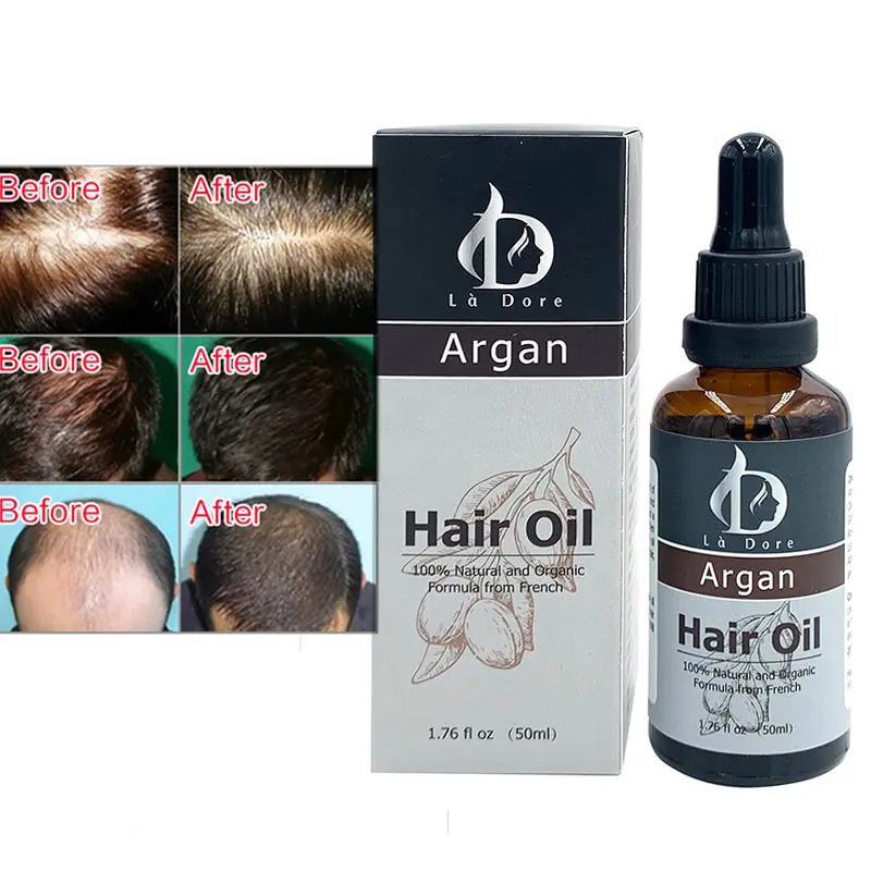 Private Label vitamina C olio di Argan per la crescita e la riparazione di olio di cheratina organico trattamento dei capelli rapida crescita dei capelli olio per gli uomini