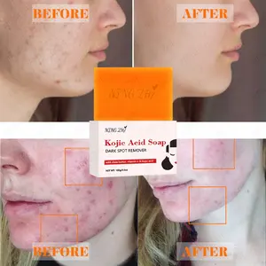 Ningzhi giá rẻ hữu cơ tự nhiên 200 G lớn Kojic axit Alpha Arbutin Thanh xà phòng cho da trống