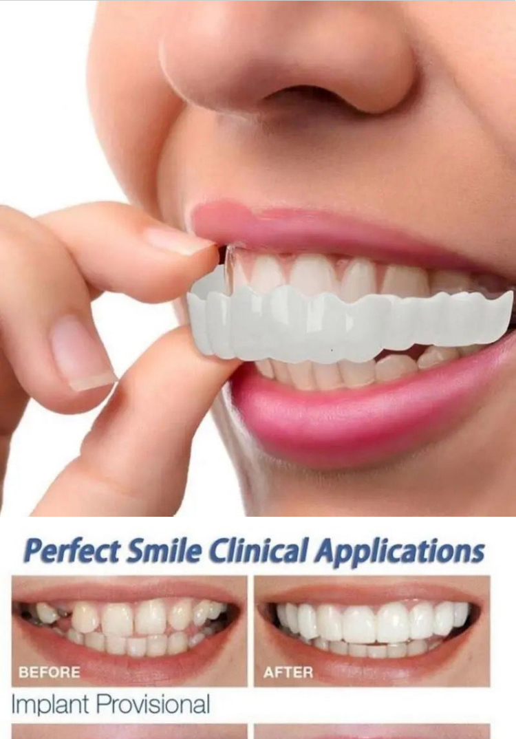 2021 New snap smile customized label Upper lower False teeth cover Perfect Smile Veneers Comfort Fit Flex Denture braces