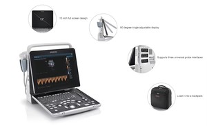 Máy siêu âm <span class=keywords><strong>Mindray</strong></span> Z50S, thương hiệu <span class=keywords><strong>Mindray</strong></span>, máy siêu âm di động, máy siêu âm Doppler màu, máy siêu âm xách tay - Product Image 2