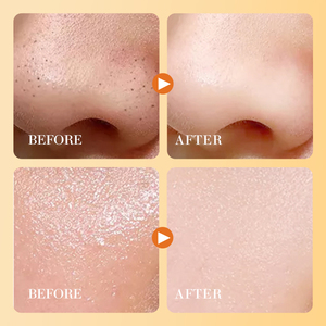 SADOER Kit de Soins Cutanés Naturels à la Vitamine C, Hydratant Éclaircissant Visage, Mains, <span class=keywords><strong>Yeux</strong></span> et Corps, Huile et Gel Exfoliant – Meilleures Ventes - Product Image 6