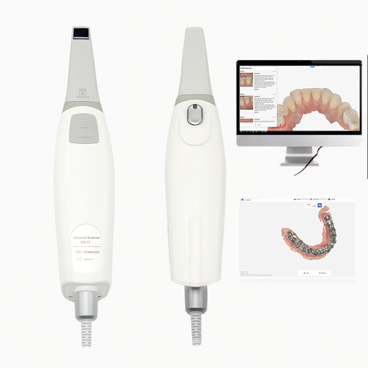 intraoral scanner woodpecker