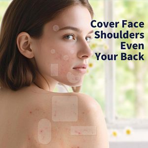 Traitement hydrocolloïde médical kystique Traitement de l'acné Zit Patches <span class=keywords><strong>Gunk</strong></span> Out Blackhead & Pore Extractor Pimple Patches pour le visage - Product Image 1