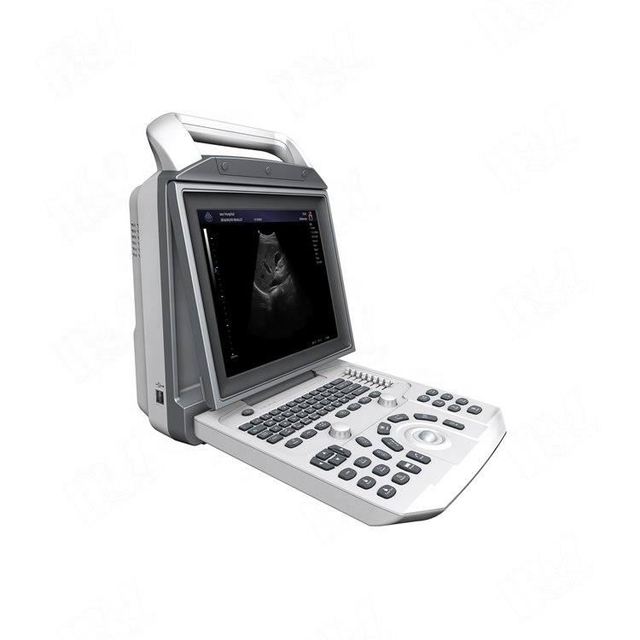 Excellent B&W Ultrasound System/ Portable B&W Ultrasound Machine for Medical