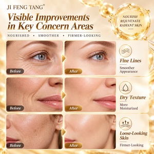 Siero Viso Anti-età al Retinolo, Antiallergico, Lenitivo, Riparatore, Antirughe, Idratante, Capsule d'Oro per la Cura della Pelle con Ceramidi - Product Image 6