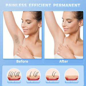 Painless New Model <strong>Lady</strong> <strong>Shaver</strong> USB Charging for Women Home Shaving Full Body Epilator with Foil Electric <strong>Shaver</strong> - Product Image 2