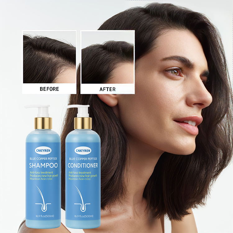 does ghk-cu help with seborrheic dermatitis GHK-Cu Copper Peptide Hair & Scalp Serum main image 1