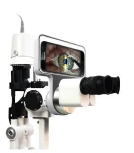 Optische ophthalmo logische Ausrüstung Smartphone Digital Slit Lamp Imaging System Preis