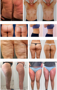 <span class=keywords><strong>Machine</strong></span> de pressothérapie de bureau professionnelle pour massage de <span class=keywords><strong>drainage</strong></span> lymphatique du corps 48 pièces airbags ABS matière plastique bras jambe - Product Image 4