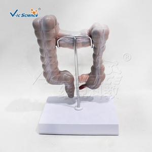 Modelo Patológico <span class=keywords><strong>de</strong></span> Intestino Grueso: Tuberculosis, Enfermedad <span class=keywords><strong>de</strong></span> Crohn, Colitis Ulcerativa, Inflamación - Product Image 4