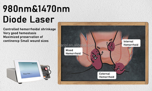 Perawatan Laser ambeien 980nm 1470nm, alat medis procologi Fistula Logi Anal penghilang pembuluh darah varises - Product Image 2