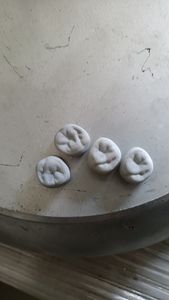 Perangkat fiksasi eksternal Internal ortopedi Motor lapisan logam semprotan Plasma implan gigi sendi tulang buatan - Product Image 6