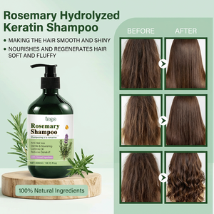 Champú de Romero Anticaída, Suave y Nutritivo, Controla la Grasa, Reduce la Caspa, Ingredientes Naturales para el Cuidado del Cabello y el Cuero Cabelludo - Product Image 4