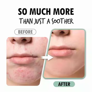 プライベートラベルCentella Asiaticaエキスなだめるような穏やかなフェイシャルセラム敏感肌と刺激肌 - Product Image 4