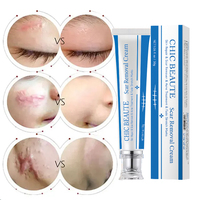 Gel Réparateur Rapide pour Cicatrices d'Acné et Vergetures, Crème Anti-Vergetures et Cicatrices pour le Corps et le Visage, Effet Raffermissant Post-Abdominoplastie