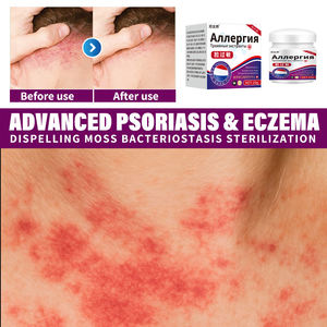 Crema Corporal para Piel Sensible 20g Herbal para Todo Tipo <span class=keywords><strong>de</strong></span> Piel con Alivio <span class=keywords><strong>de</strong></span> Alergias <span class=keywords><strong>Medicamentos</strong></span> para Uso Exterior 2 Años <span class=keywords><strong>de</strong></span> Vida Útil - Product Image 5