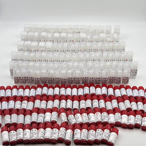 Dureté selon <span class=keywords><strong>Brinell</strong></span>, poinçon à billes HBW, diamètre des billes : 1 mm, 2,5 mm, 5 mm, 10 mm - Product Image 5