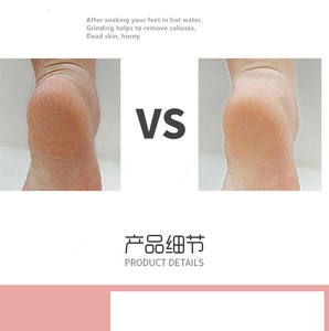 Éliminateur de callosités et de peaux dures, outil de pédicure à Double face, râpe pour enlever les callosités du pied, pièces - Product Image 5