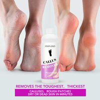 Liquide exfoliant pour les pieds 500 ml, éliminateur de callosités, adoucissant pour les pieds et les cuticules des ongles