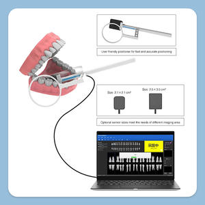 उच्च गुणवत्ता वाले डिजिटल एक्स-रे सेंसर, दंत चिकित्सा क्लिनिक दंत चिकित्सक के लिए बुद्धिमान छवि प्रसंस्करण हो सकता है - Product Image 2