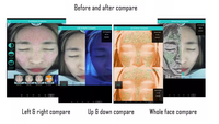 Analyseur Facial 3D Tendance 2026 : Détection Automatique de l'Hydratation du Visage et Système de Diagnostic Cutané – Machine d'Analyse de la Peau