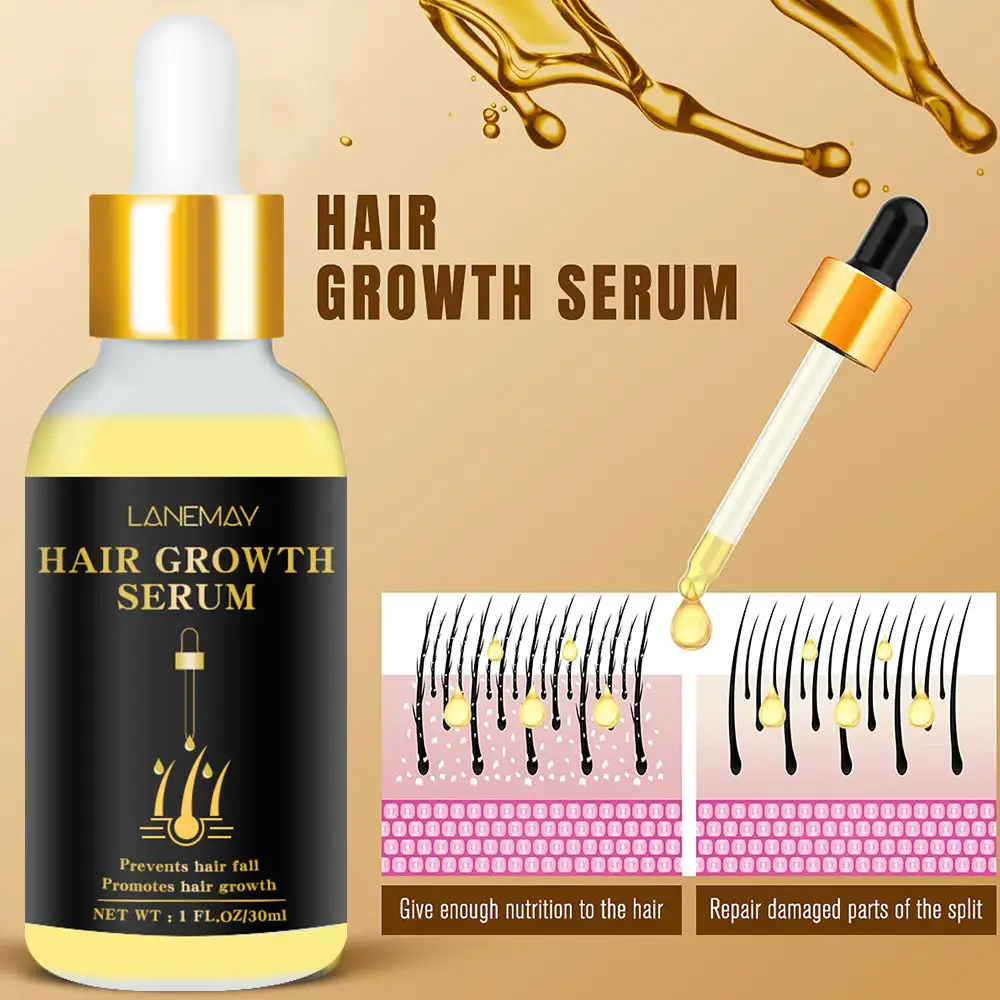 Private Label Natural Bald Hair Growth Supplement Serum Soin Cheveux Ginger Hair Growth Oil per la cura dei capelli