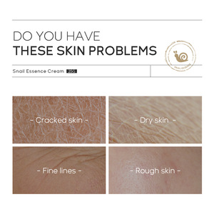 Toptan salyangoz <span class=keywords><strong>Serum</strong></span> yüz kremi yumuşatma ince çizgiler esneklik nemlendirici krem geliştirmek - Product Image 5