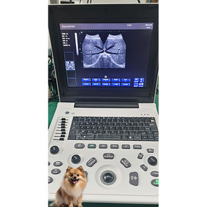 <span class=keywords><strong>Ultrasound</strong></span> Scan B Scan generasi baru dilengkapi dengan berbagai fungsi praktis sistem <span class=keywords><strong>Ultrasound</strong></span> - Product Image 3