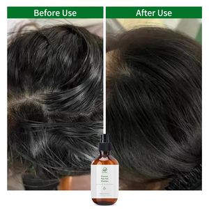 Shampooing Bio <span class=keywords><strong>Anti</strong></span>-<span class=keywords><strong>Chute</strong></span> Fortifiant les Racines des <span class=keywords><strong>Cheveux</strong></span> Marque Blanche 300ml Volumisant et Sans Silicone pour Hommes et Femmes - Product Image 4